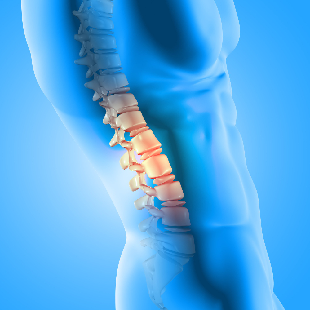 Disc Injuries