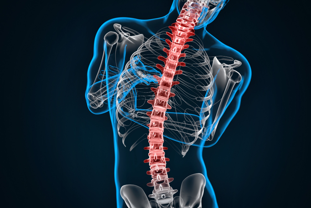 Facet Joint Impingements